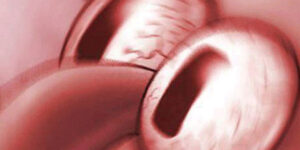 Tranquille les warnings