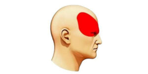 T'as pas un Doliprane ?